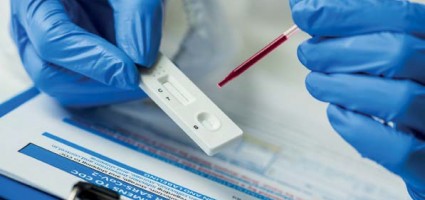 Коронавирус и ВИЧ-инфекция 